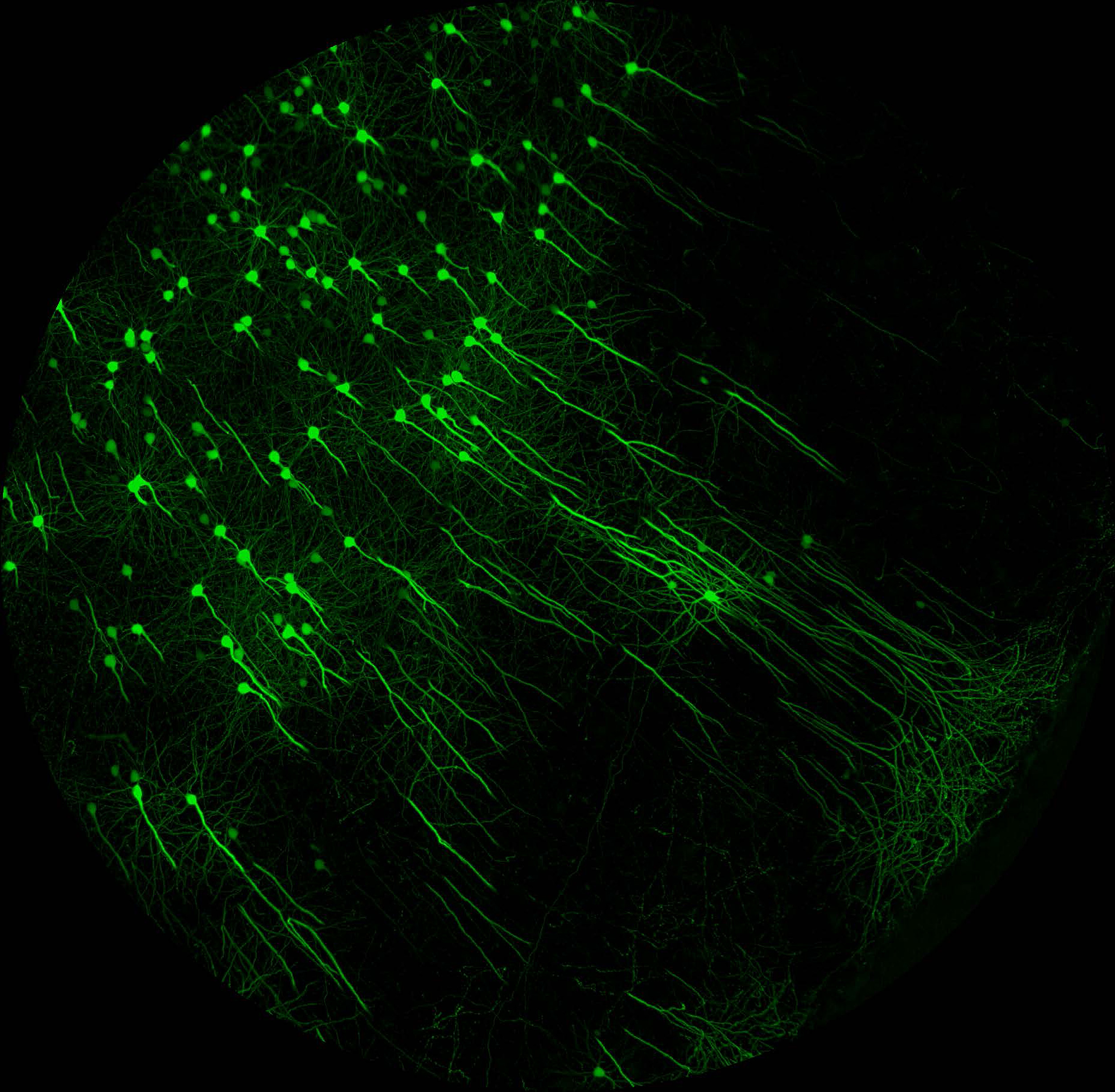 Chemical treatment turns biological tissue transparent.