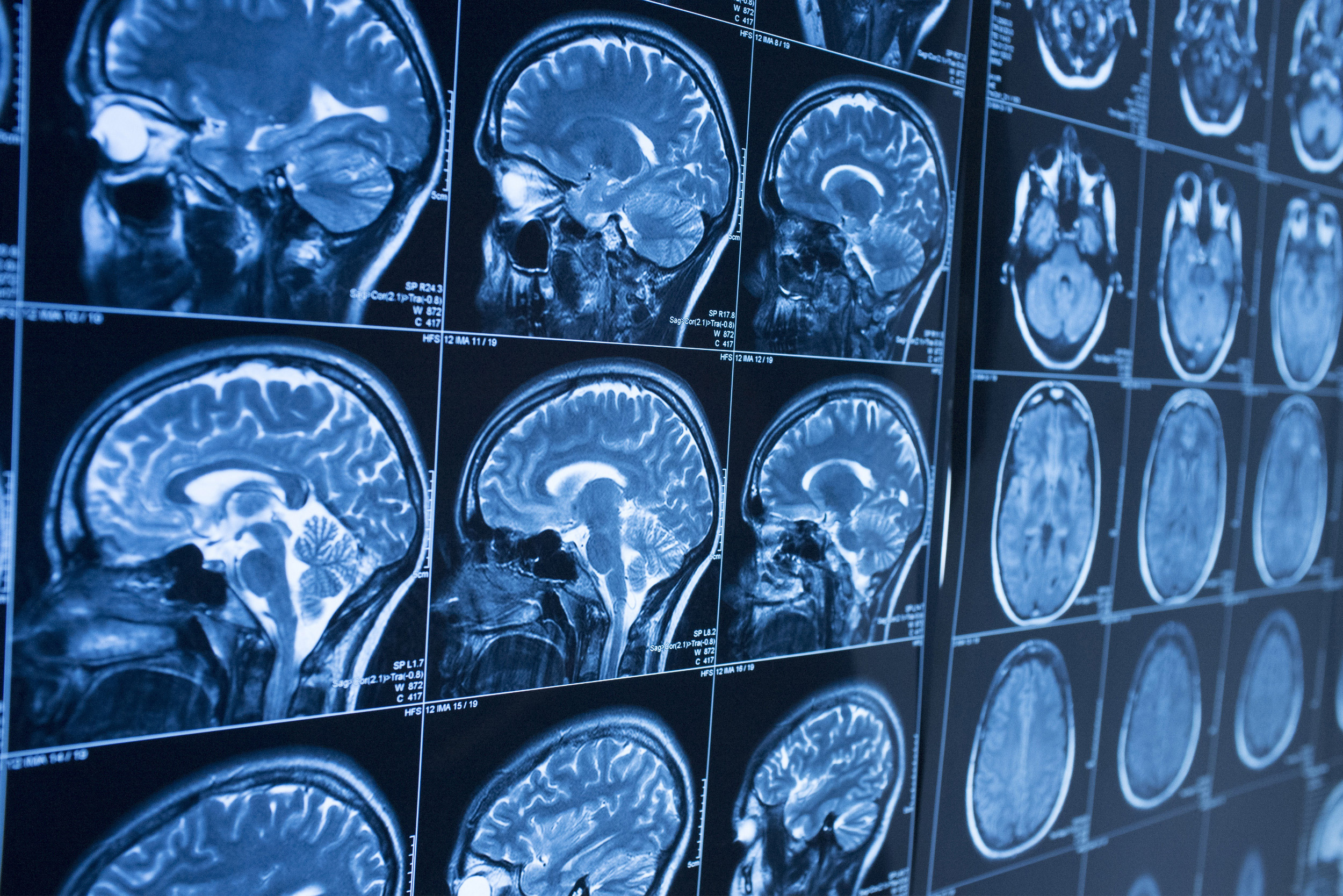 Measuring brain function image of scans