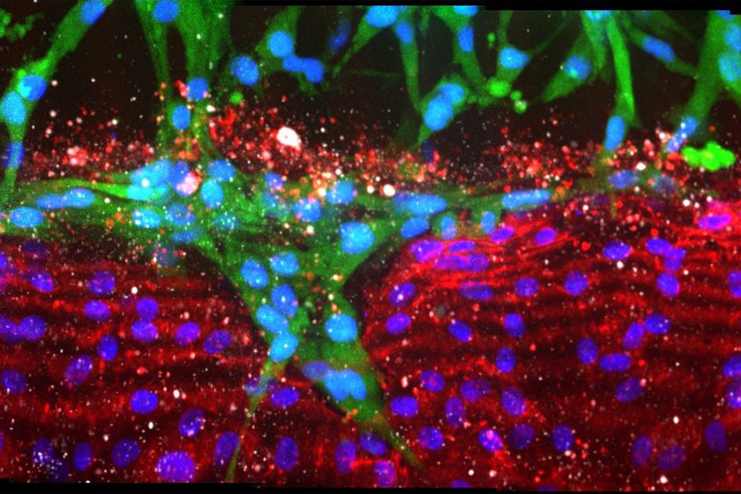 Pancreatic cancer cell