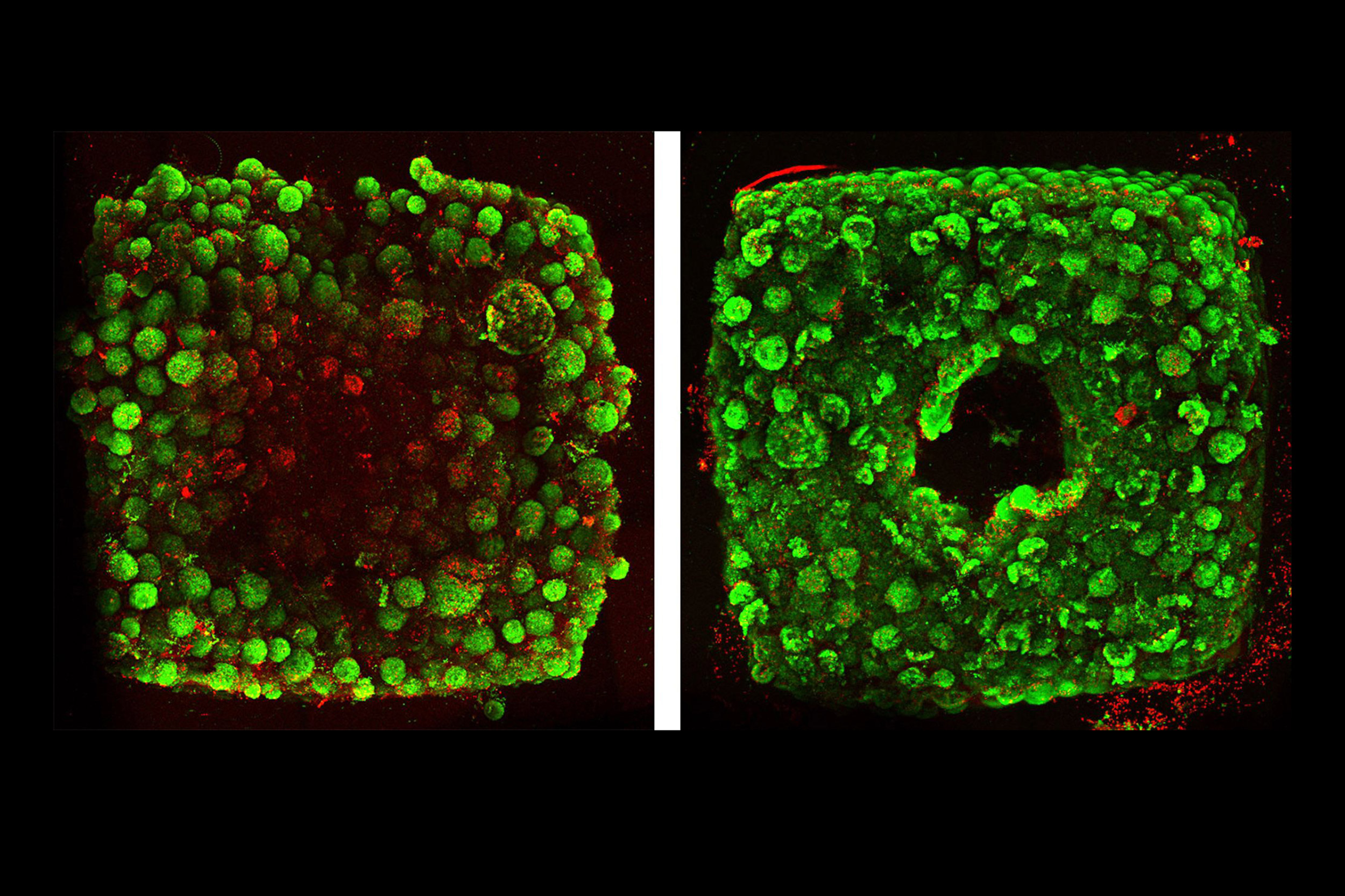 SWIFT vascular channels