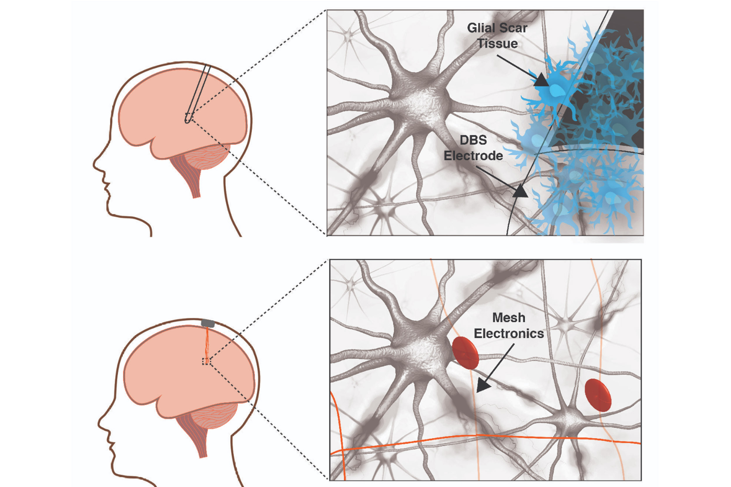 raditional-neural-electrodes-versus-mesh-electronics