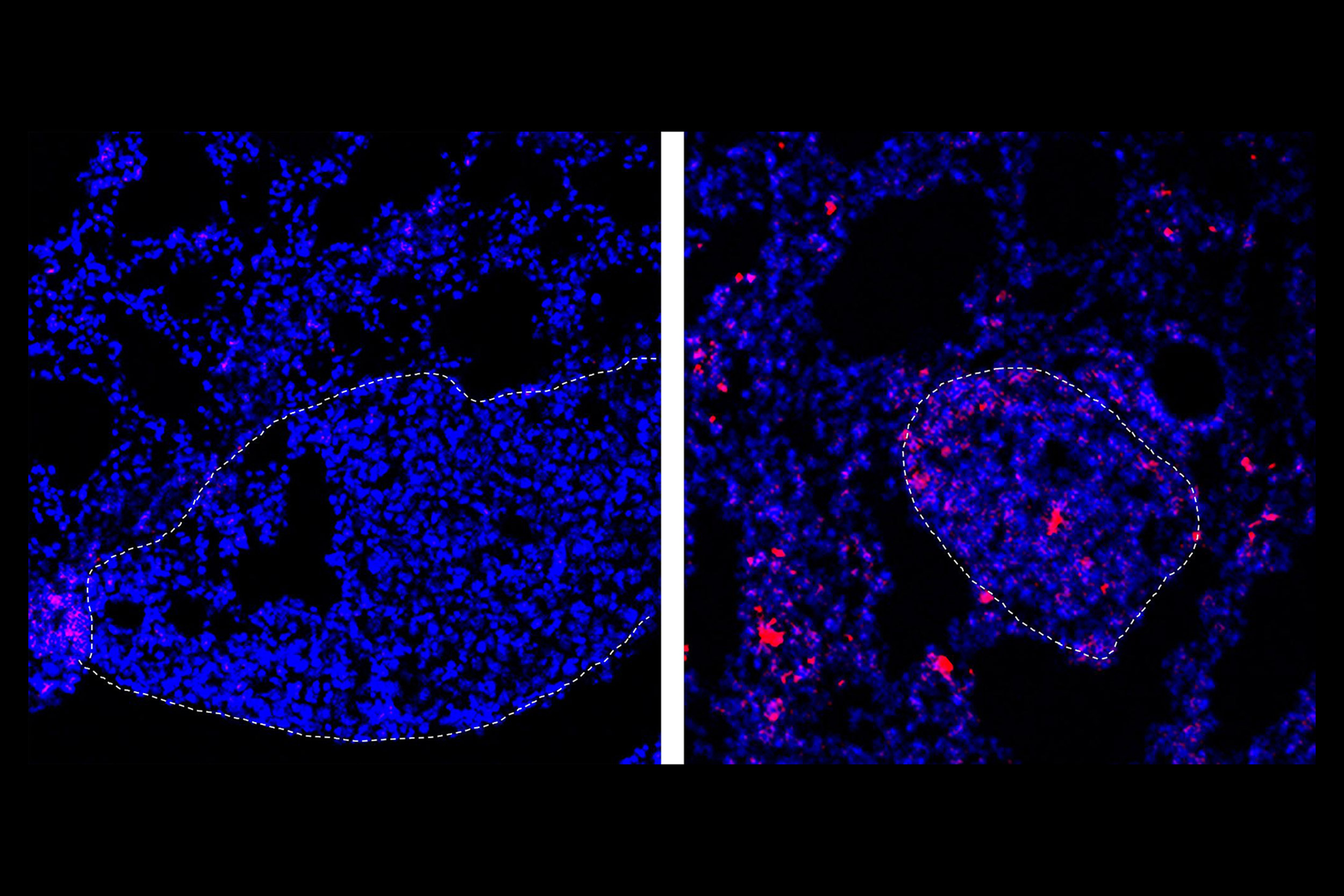 Cells with chemo drugs