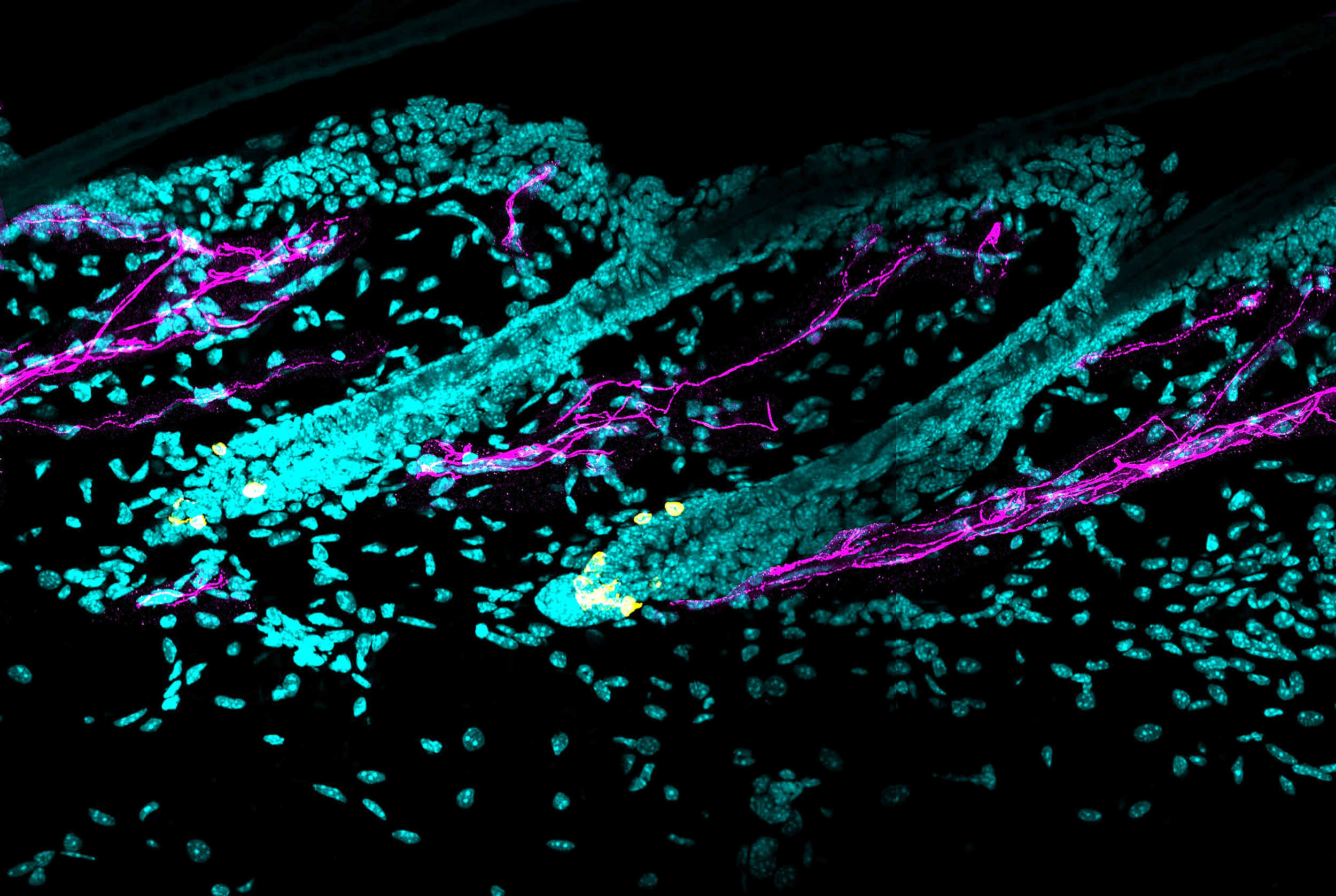 Melanocyte stem cells.