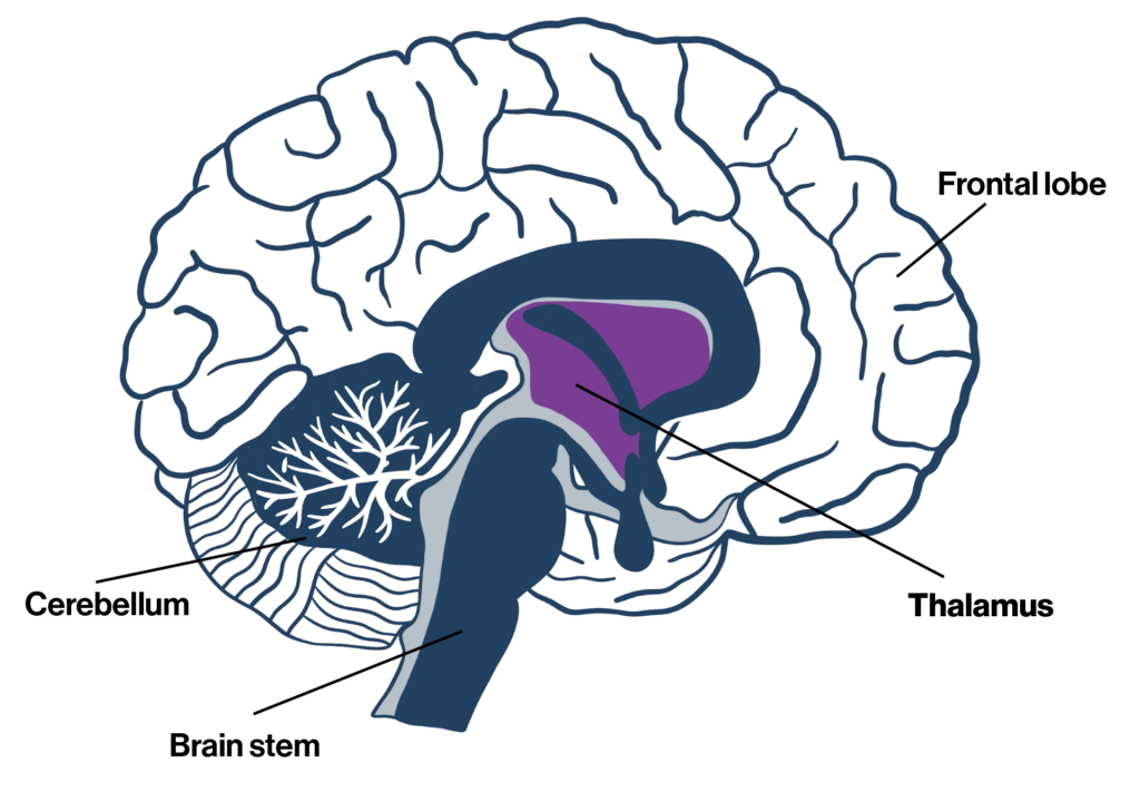 case study neuropsychology