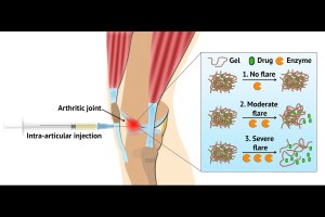 A delivery system using hydrogel
