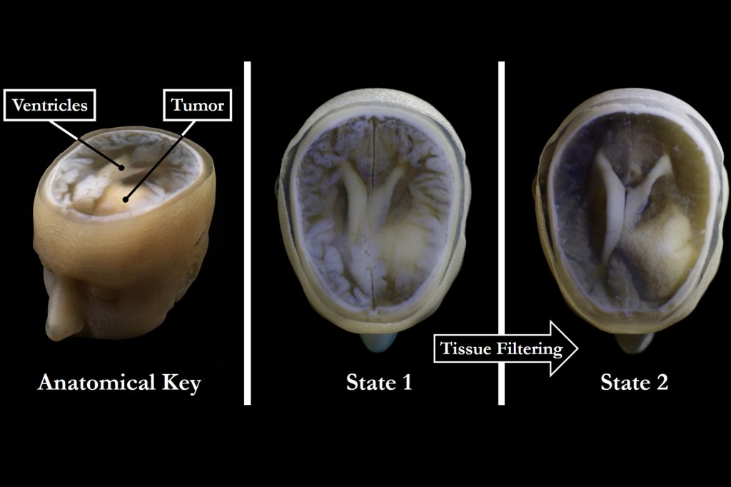 Brain model