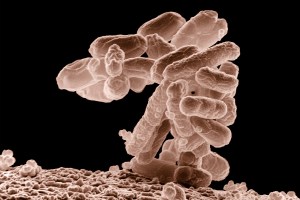E coli