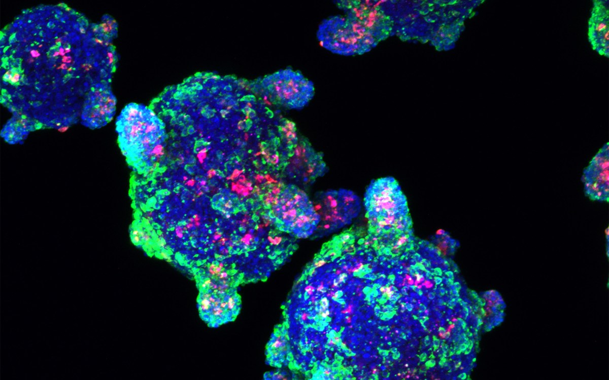 Beta cells made from stem cells, as seen under the microscope.