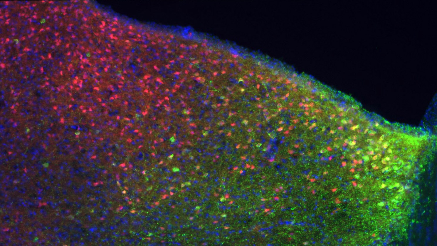 Somatostatin neurons