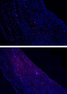 Treated and untreated muscles.