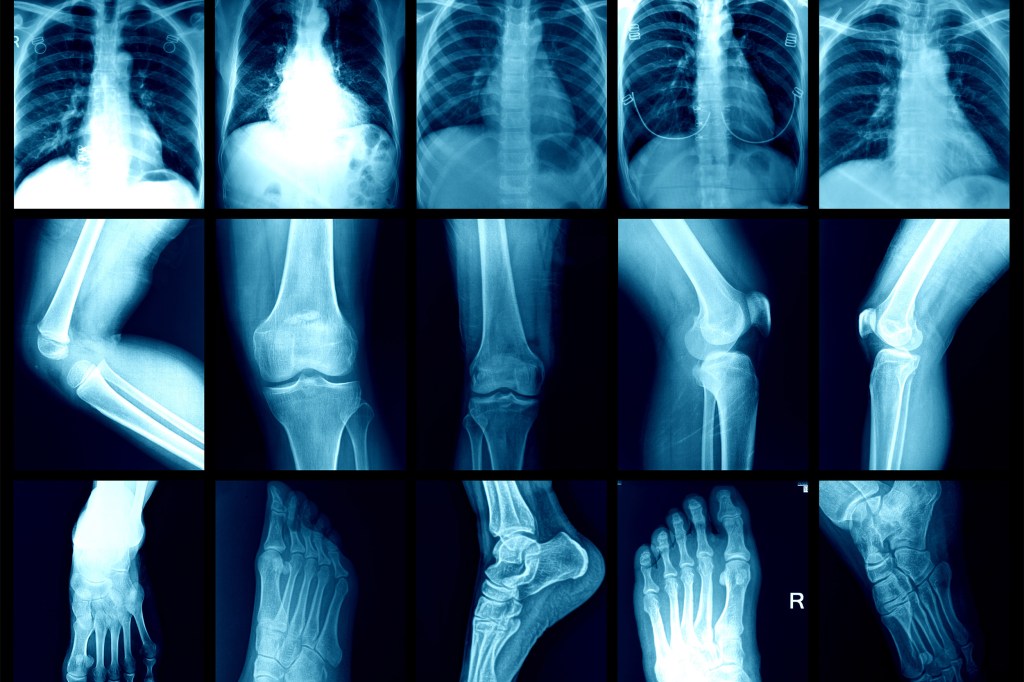 X-ray collage showing various joints, spine, and neck.