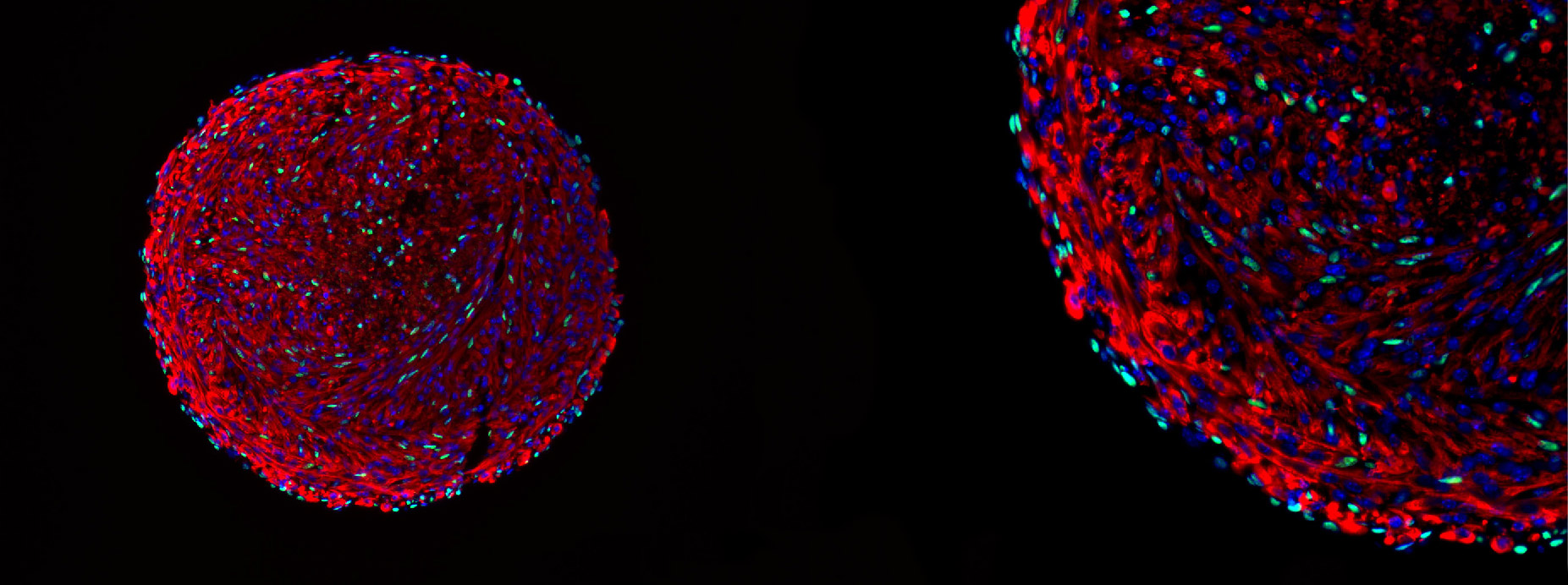 Microscopy image of a skeletal muscle organoid. The green cells are in vitro-derived satellite cells.